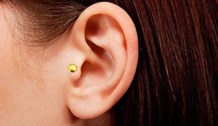 Серьга для похудения